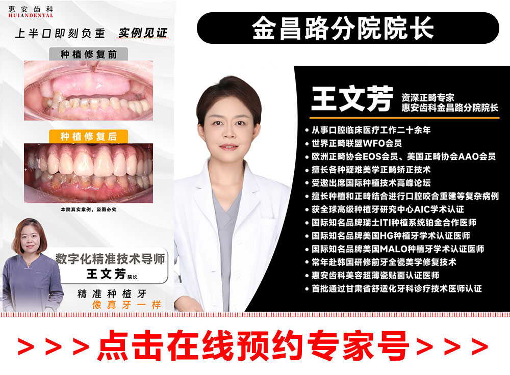 兰州牙科，兰州口腔，兰州种植牙，兰州种植牙，兰州种植牙医院，兰州种植牙口腔