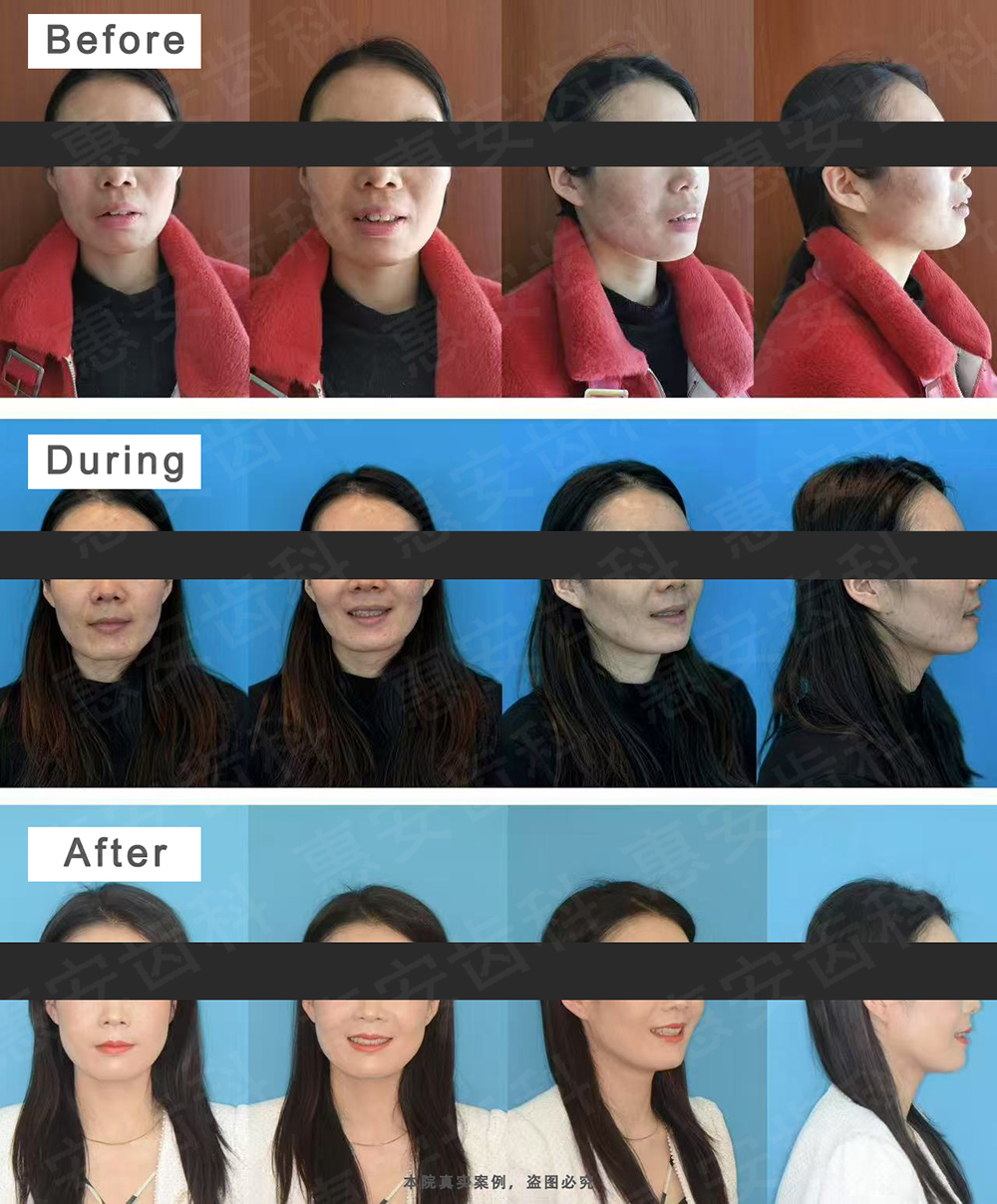 兰州牙科，兰州口腔，兰州矫正牙齿，兰州牙齿矫正，兰州正畸，兰州矫正牙齿哪家好，兰州正畸