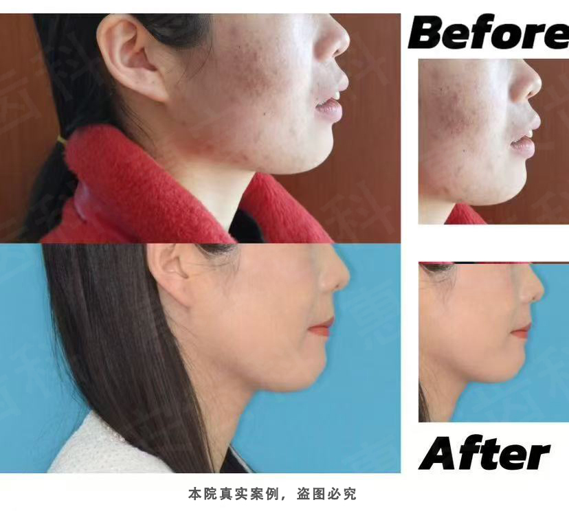 兰州牙科，兰州口腔，兰州矫正牙齿，兰州牙齿矫正，兰州正畸，兰州矫正牙齿哪家好，兰州正畸